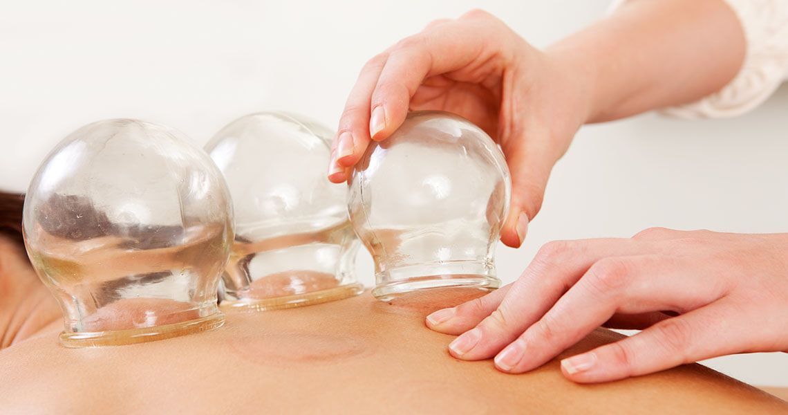 Cupping (Myofascial Decompression)